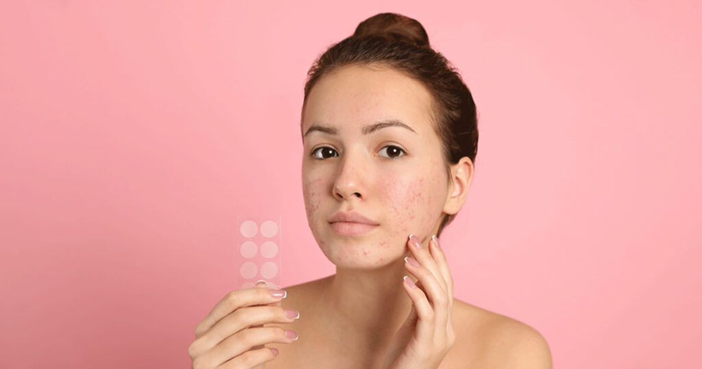 do pimple patches leave scars